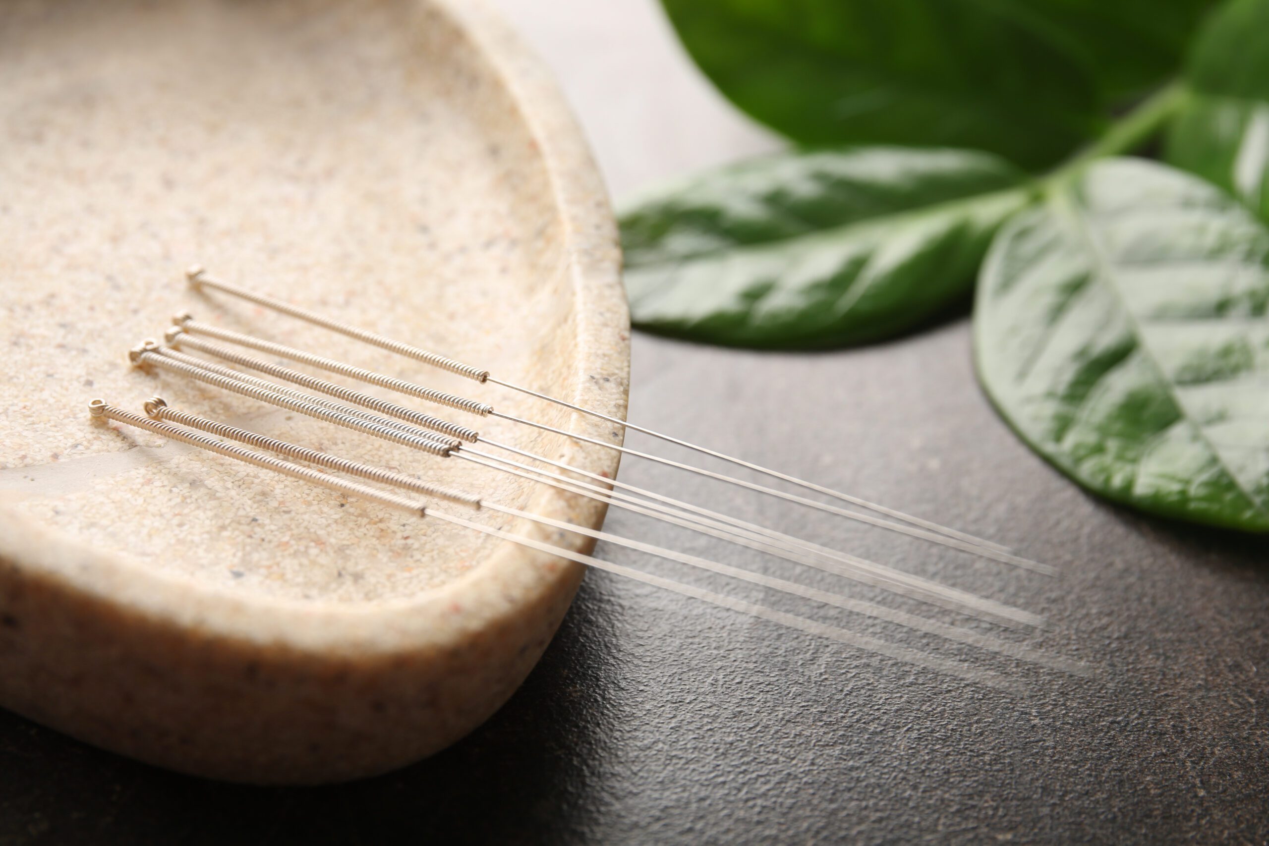 The Benefits of Acupuncture